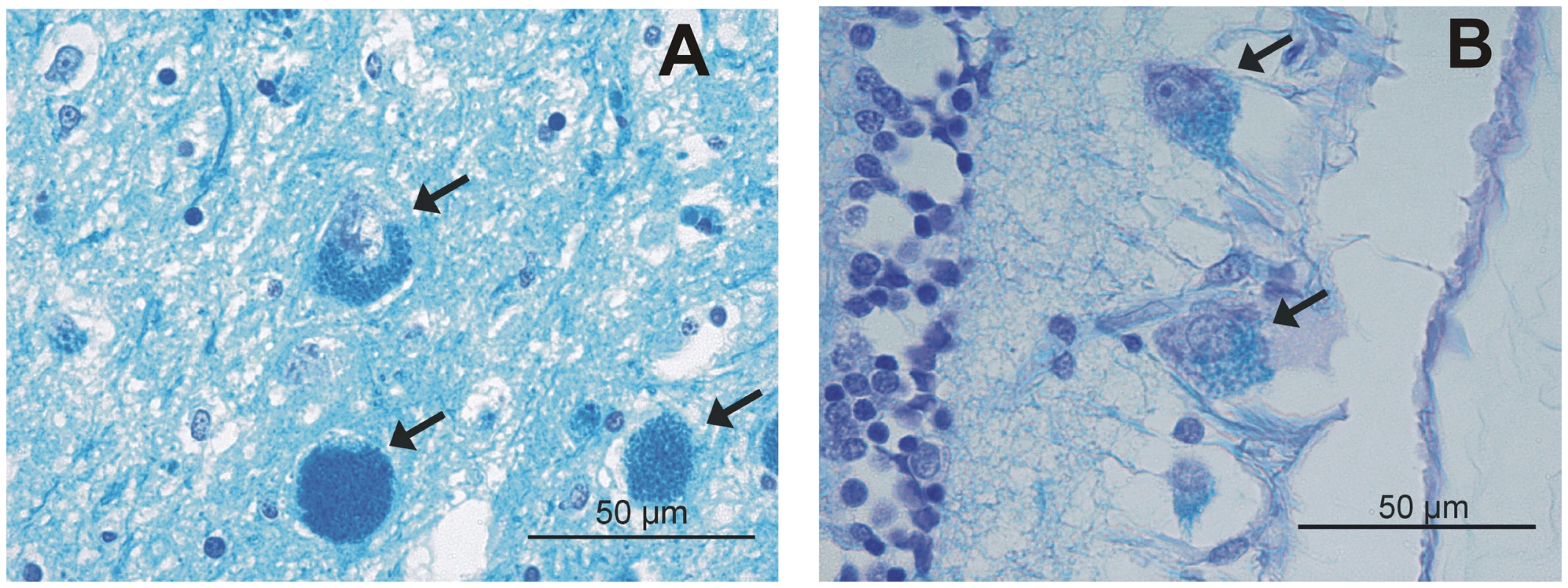 Luxol fast blue (LFB) staining.