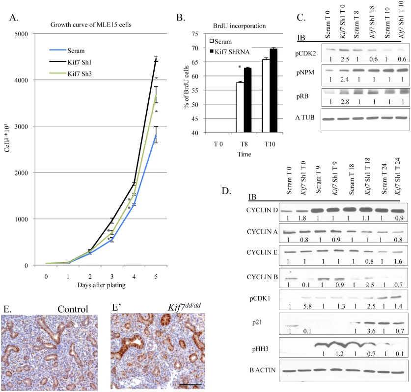 KIF7 Regulates cell proliferation and entry into S phase in mouse lung epithelial cells.