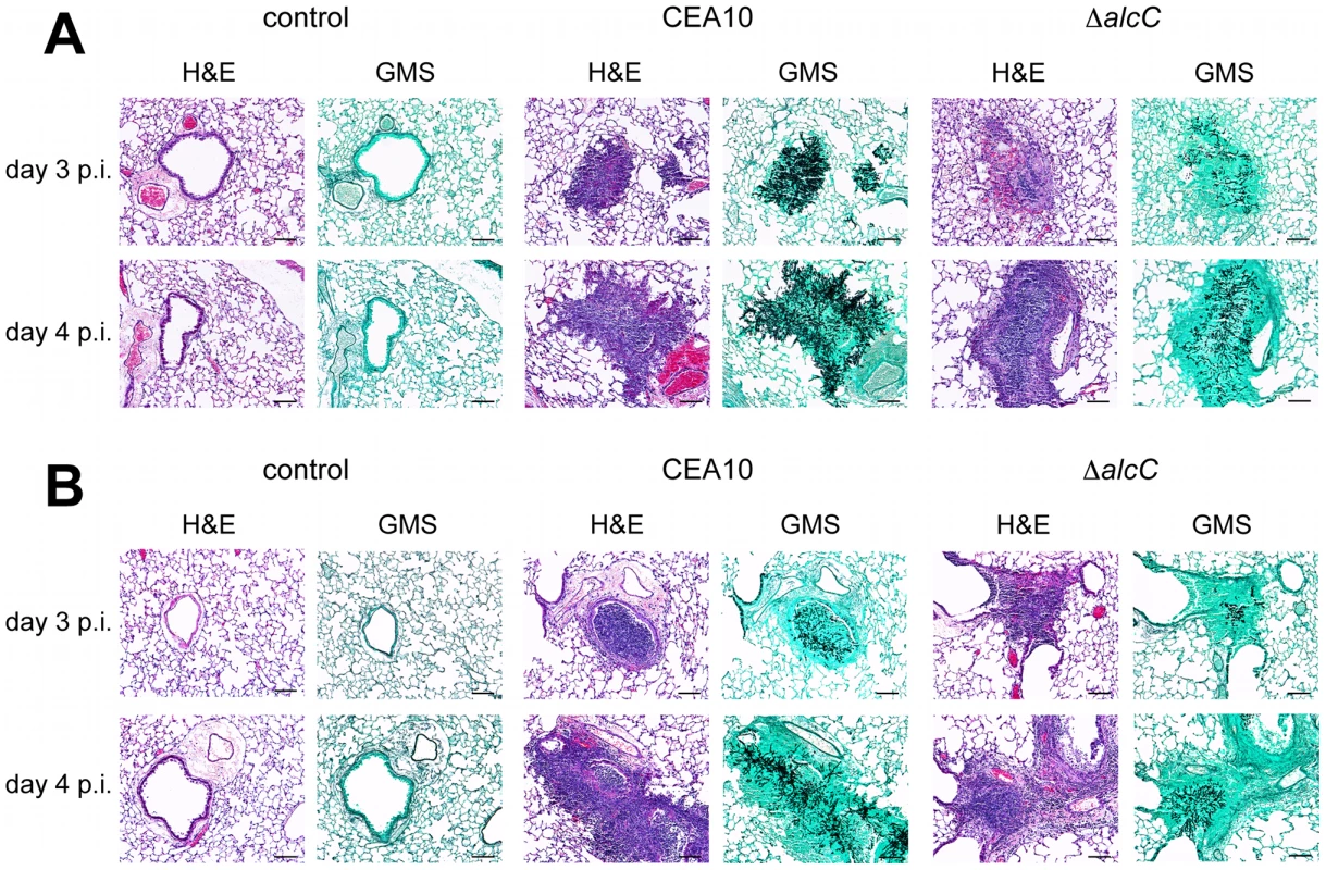 Representative histopathology of the chemotherapy and triamcinolone mouse models 3 and 4 days after inoculation.