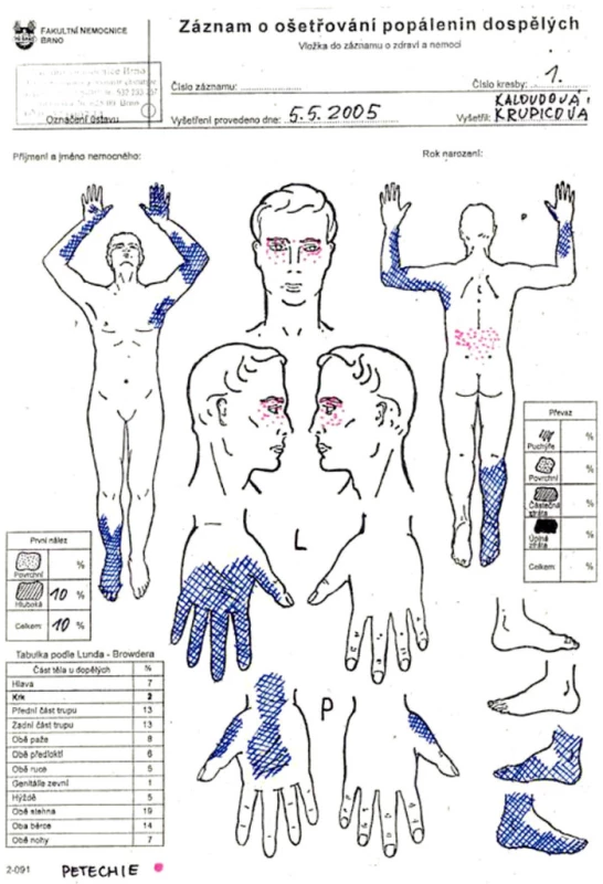 Documentation of burn wounds care of the patient