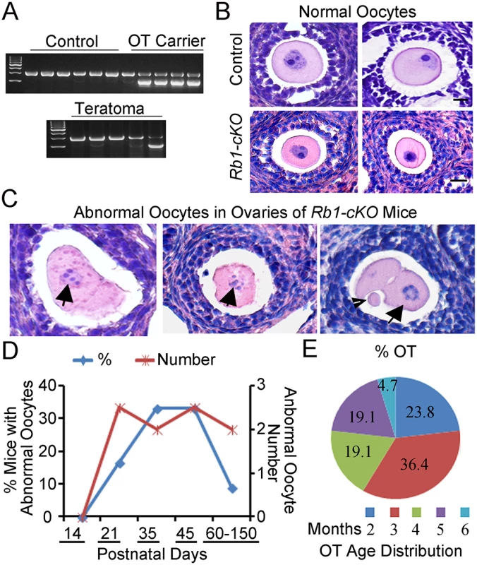 Premature resumption of meiosis in preantral follicles of mice with conditional <i>Rb1</i> inactivation in oocytes.