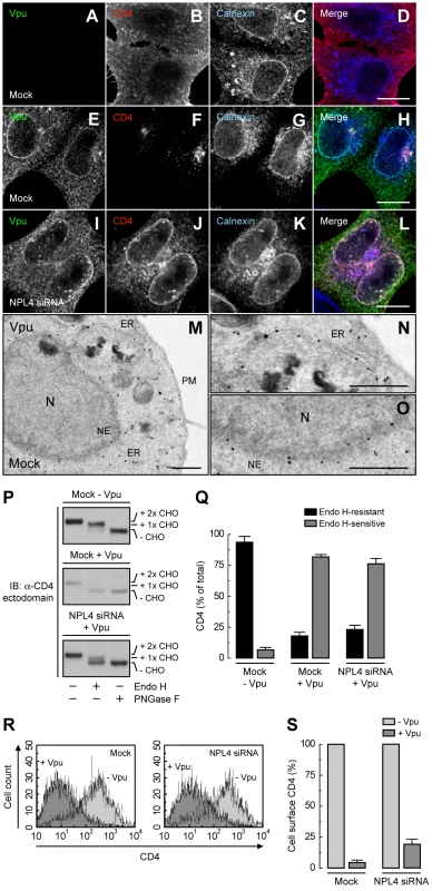 ER retention of CD4 mediated by Vpu.