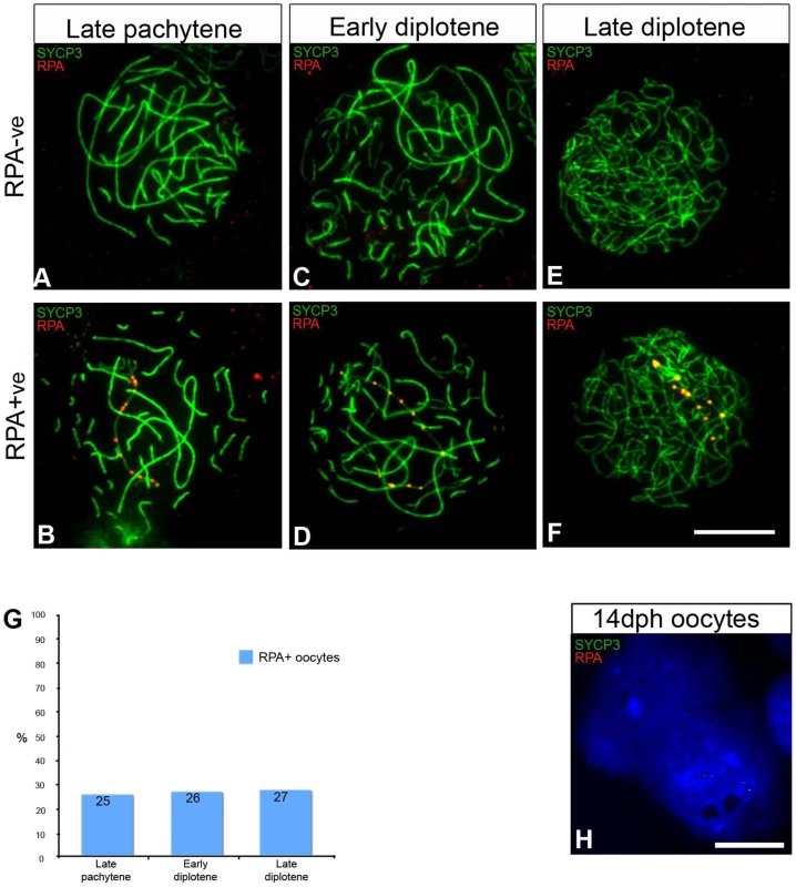 Oocytes with unresolved DNA DSBs on the Z chromosome progress to diplotene.