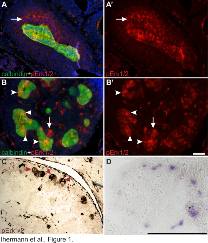 Localization of MAPK pathway activity in developing kidney.
