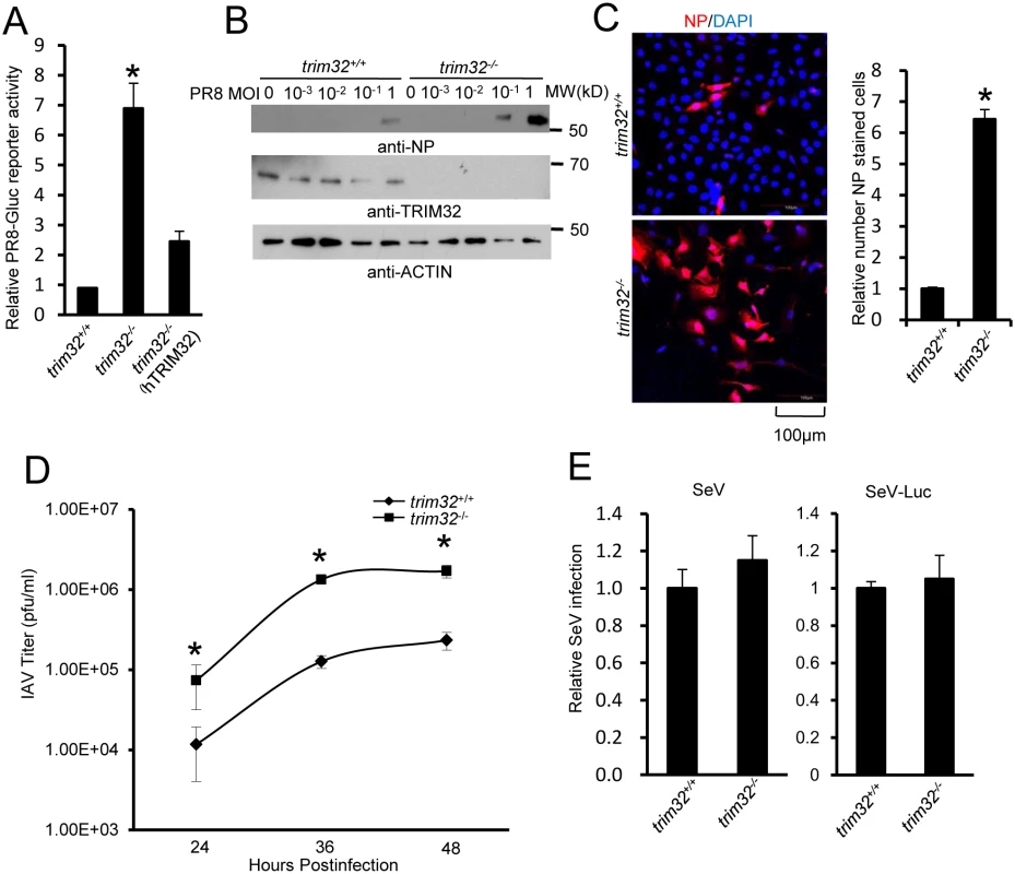 TRIM32 deficiency increases susceptibility to influenza A virus infection.