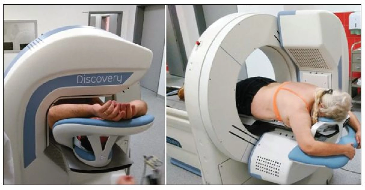 Akvizice dat v supine (vlevo) a prone (vpravo) pozici na CZT kameře GE Discovery 530c 
(odd. Nukleární kardiologie ve FN u Sv. Anny, Brno).