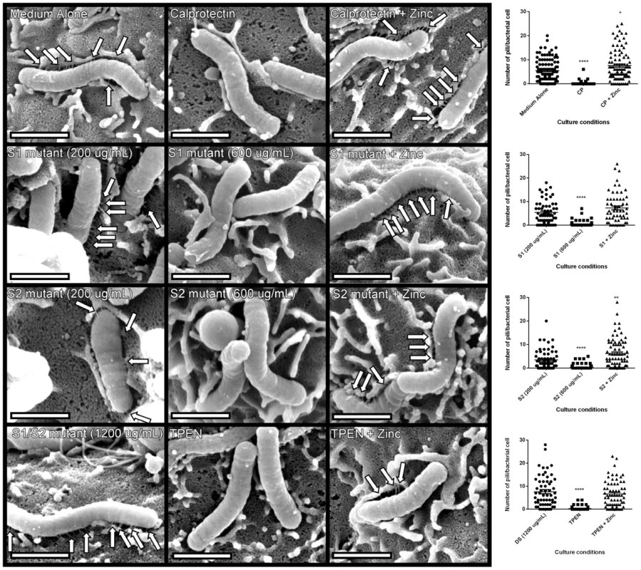 <i>H. pylori cag</i> T4SS pilus production is modulated by the zinc sequestration activity of calprotectin.
