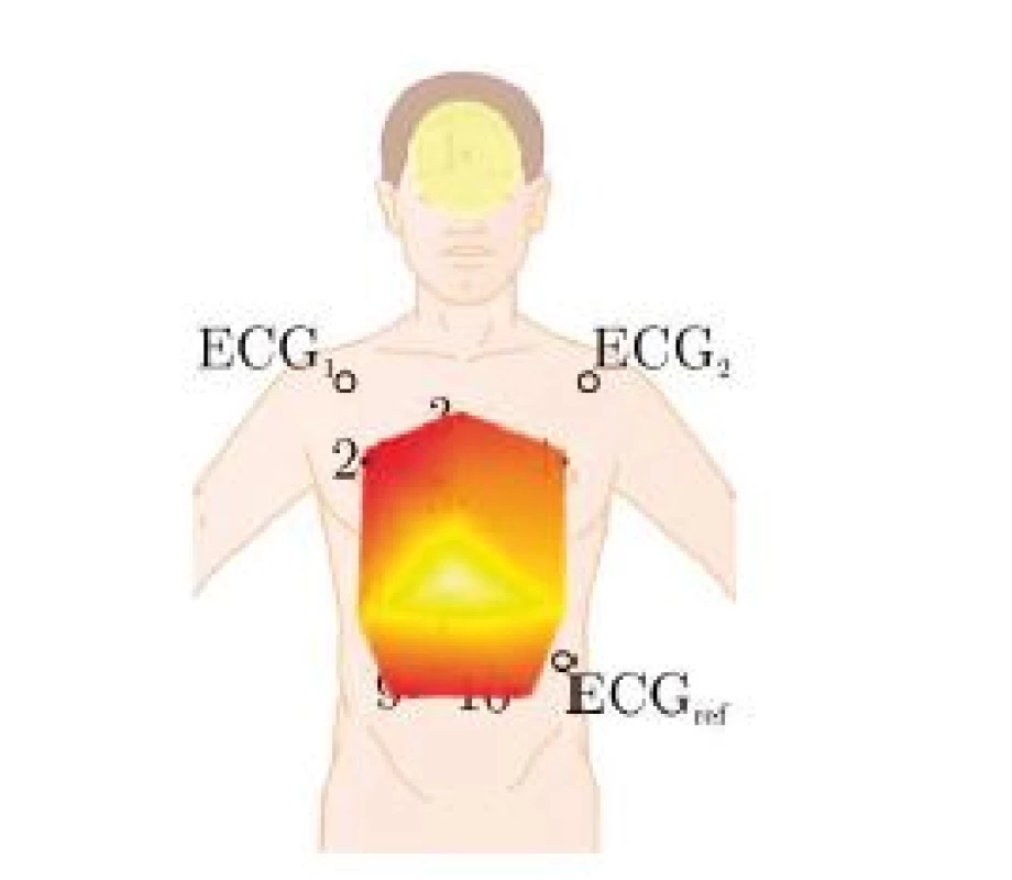 Mapping of the color-coded ranges, see also Fig. 6. Note that the mapping is slightly distorted as the subjects were monitored in a sitting position with a recline of approximately 20°.