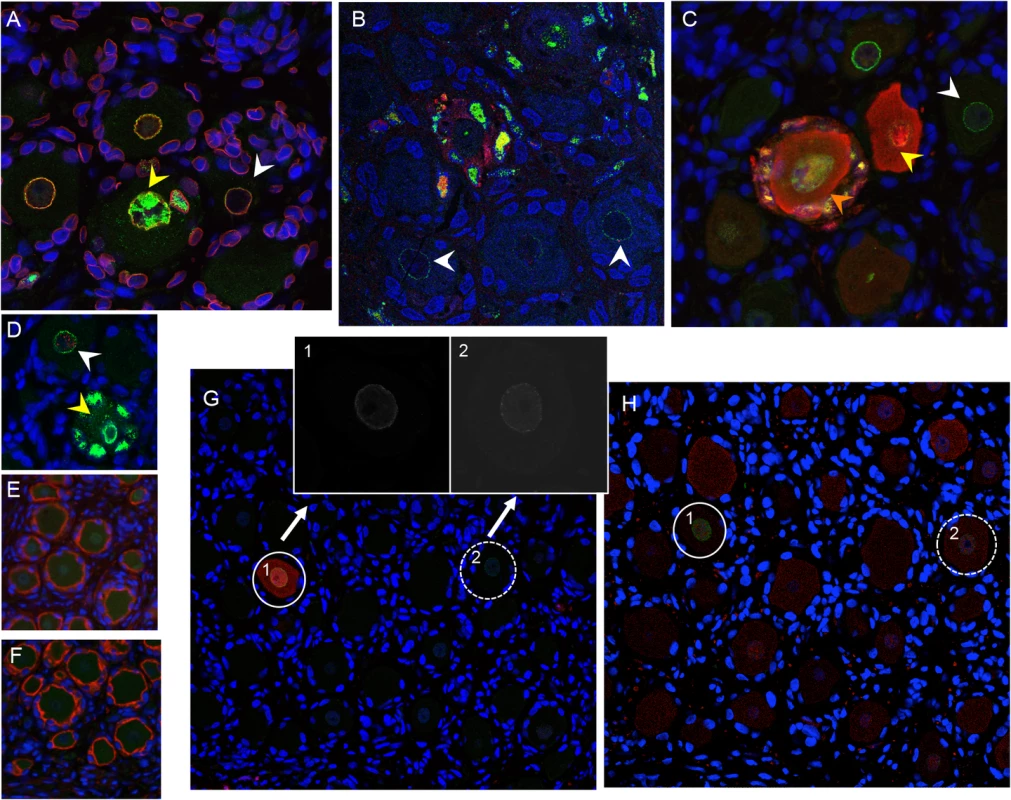 VZV restriction in mechanoreceptive neurons occurs after viral entry.
