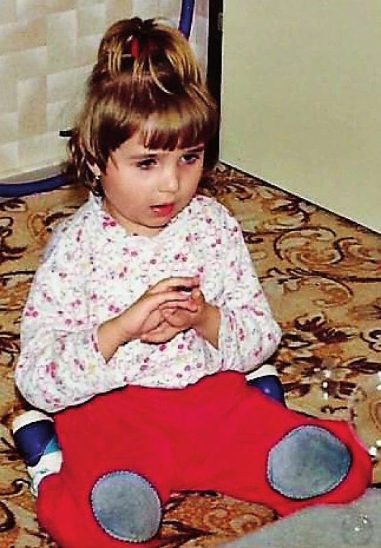 Dívka s Rettovým syndromem, 3,5 roku, mycí pohyby rukou.