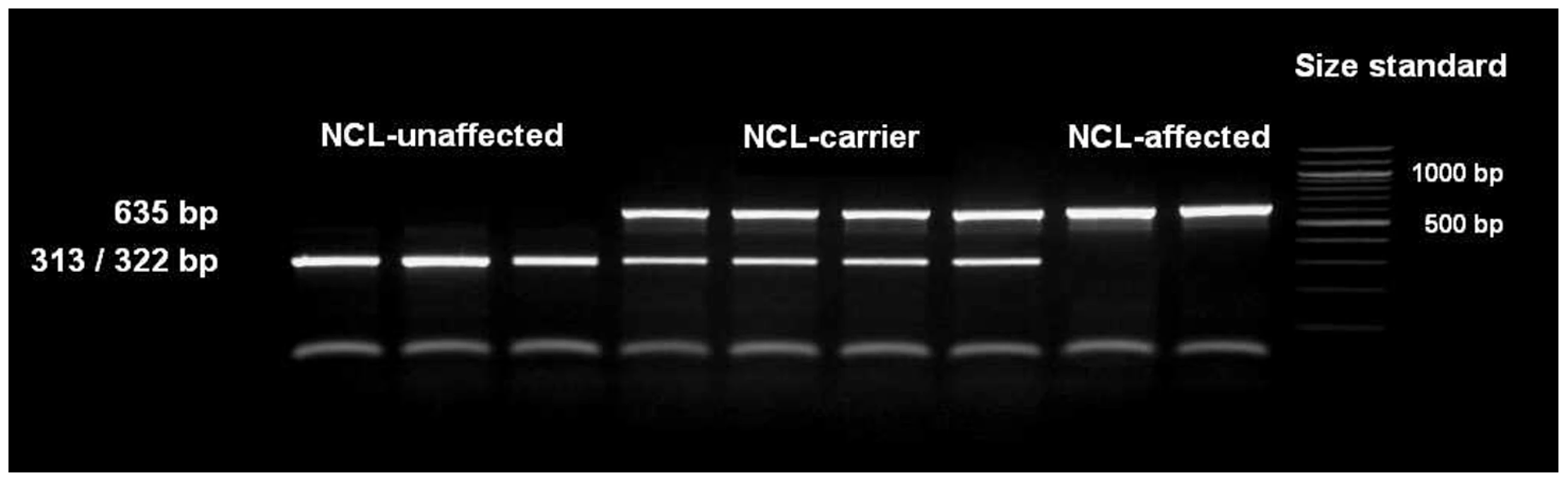 Detection of the <i>ATP13A2</i> one base pair deletion.