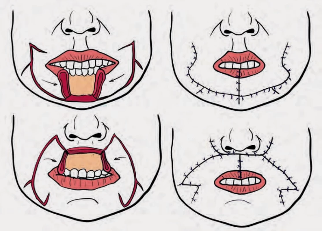  Fig. 9.