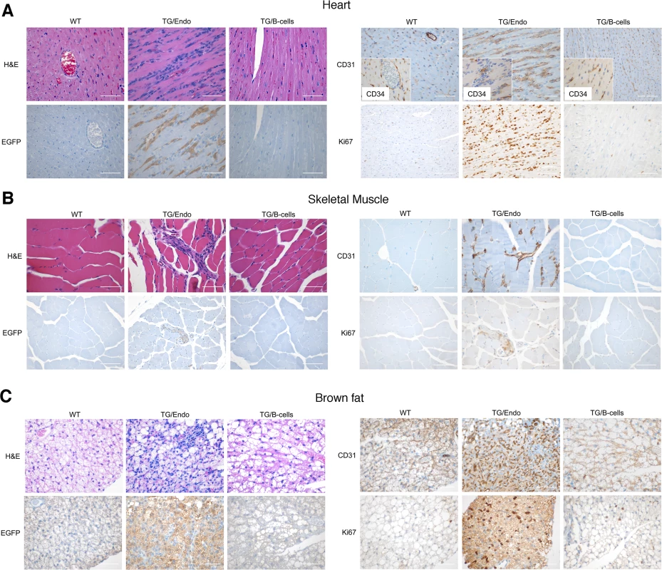 Systemic endothelial abnormalities.