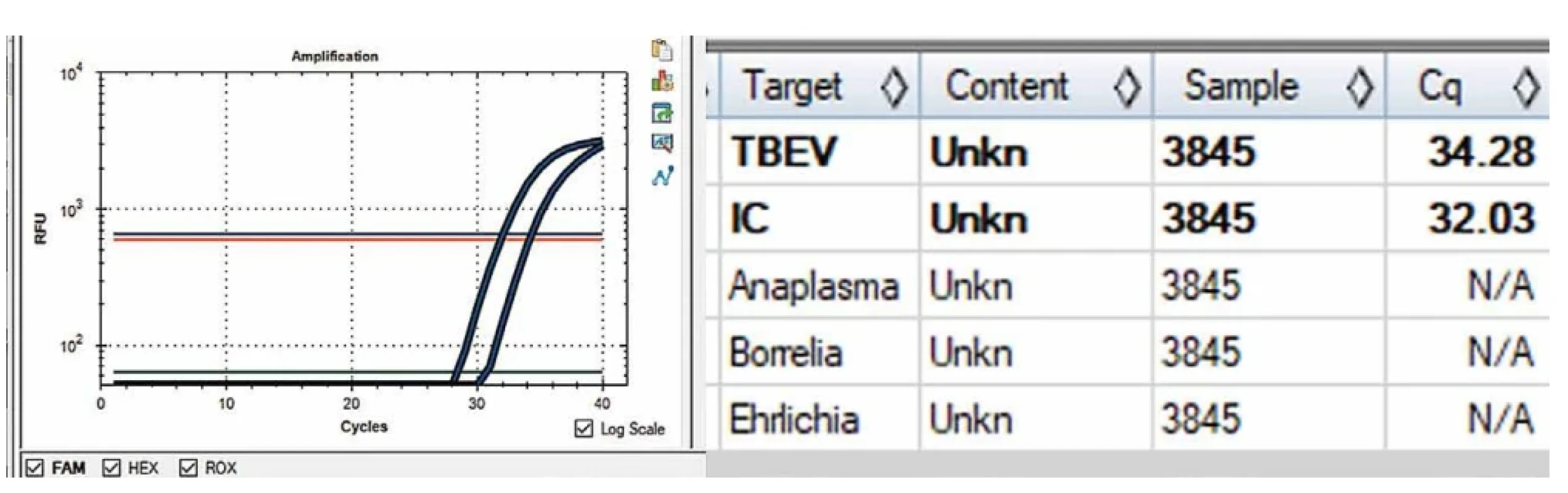 Pozitivní pacientský vzorek na klíšťovou encefalitidu TBEV – tick borne encephalitis virus, IC – interní kontrola PCR reakce (foto B. Macúchová, vlastní fotografie, Laboratoře AGEL a.s.) Figure 4. A patient sample positive for tick-borne encephalitis TBEV – tick-borne encephalitis virus, IC – PCR internal control (photo by B. Macúchová, original photograph, AGEL Laboratories, Inc.).