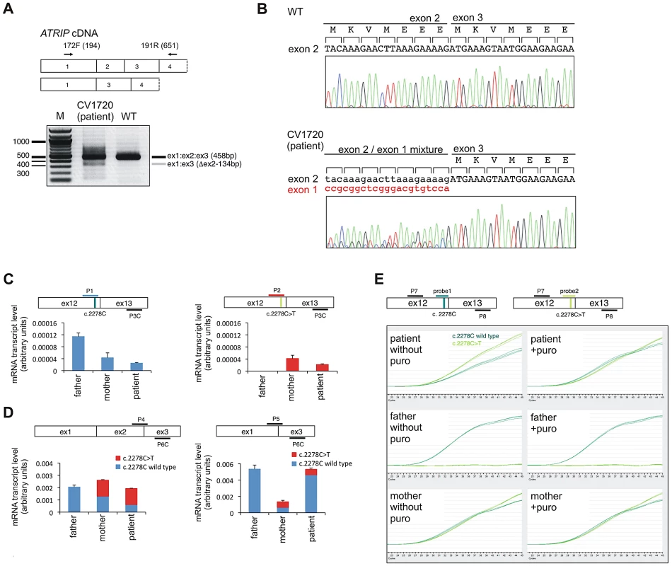 Identification of mutational changes in <i>ATRIP</i> in CV1720.