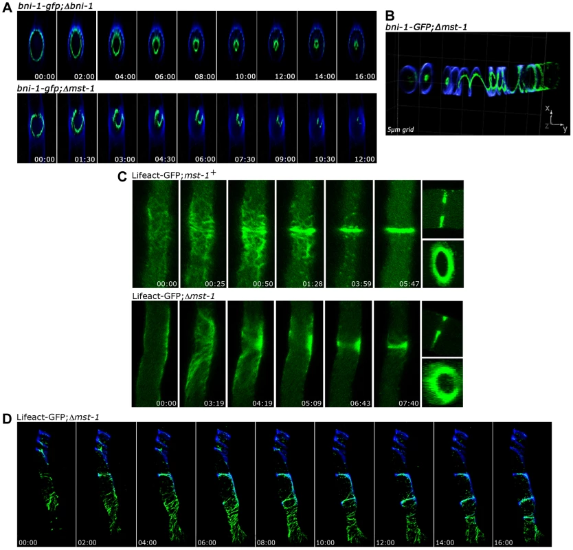 MST-1 is required for proper contractile actin ring formation.