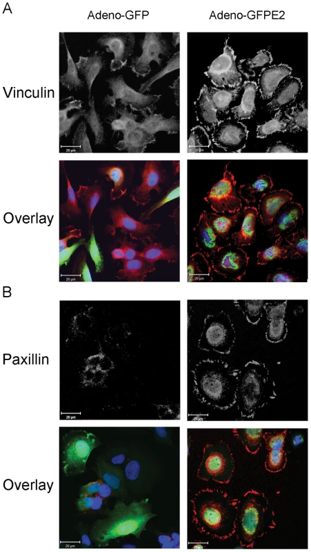 E6/E7 repression by E2 induces focal adhesion in SiHa cells.