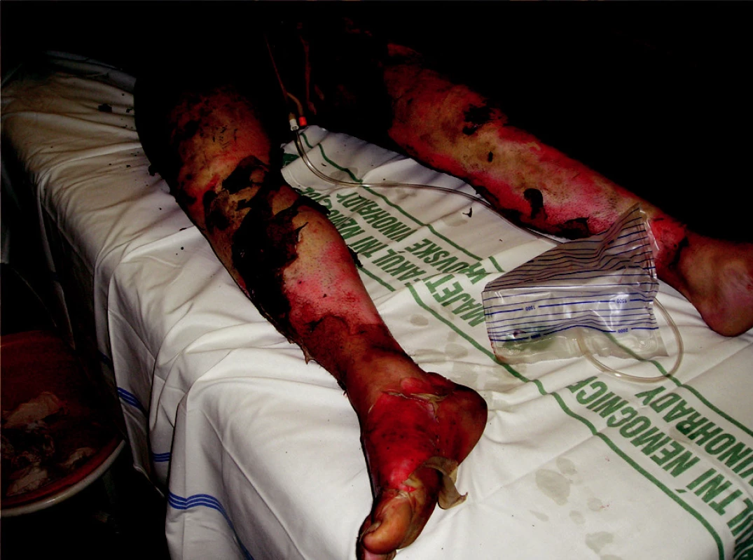 General view of the patient on admission