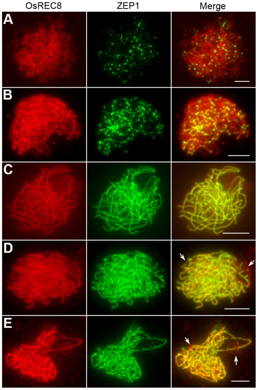 Immunolocalization of ZEP1 in the <i>Oshus1-1</i> mutant.