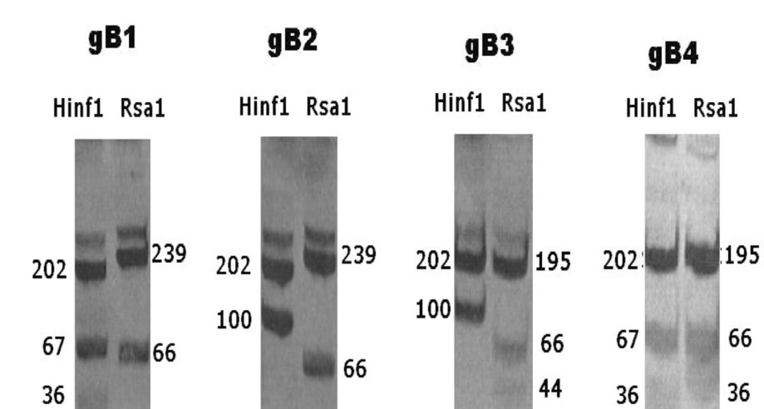 Vzorec produktů RFLP u jednotlivých genotypů gB
Fig. 1. RFLP patterns of different gB genotypes