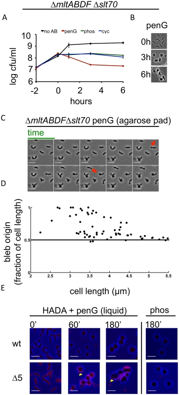Deletion of multiple lytic transglycosylases alters the kinetics of <i>V</i>. <i>cholerae</i> sphere formation after inhibition of cell wall synthesis.
