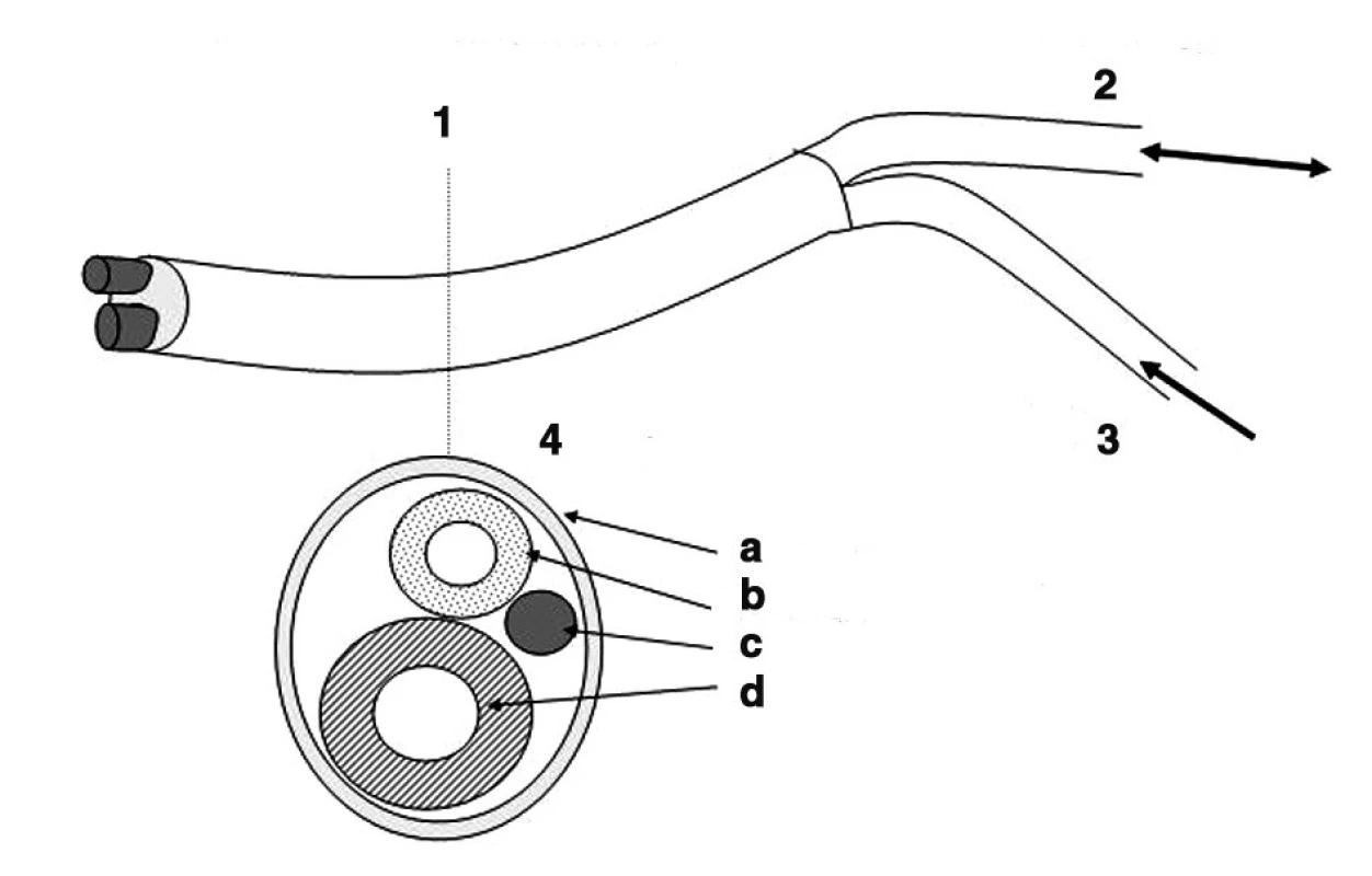 Schematické znázornenie katétra pre katétrovú vysoko - frekvenčnú ventiláciu pľúc
1 – Katéter pre katétrovú VFDV – schéma
2 – Paw – meranie
3 – Pin (kPa)
4 – Rez A-A
a – obal
b – merací katéter
c – kovová výztuha – stabilizátor
d – insuflačný katéter