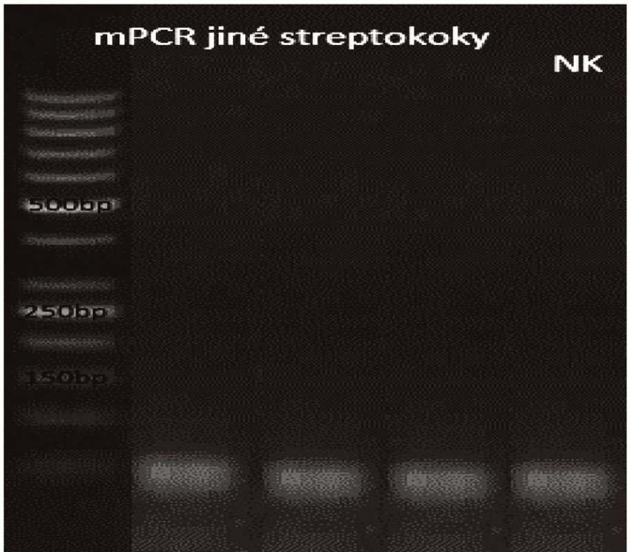 Příbuzné streptokoky
Dráha 1: 50bp DNA Ladder
Dráha 2: <i>S. pseudopneumoniae</i>
Dráha 3: S. sanguinis</i>
Dráha 4: S. oralis</i>
Dráha 5: negativní kontrola<br>
Fig. 10. Related streptococci
Lane 1: 50bp DNA Ladder
Lane 2: <i>S. pseudopneumoniae</i>
Lane 3: <i>S. sanguinis</i>
Lane 4: <i>S. oralis</i>
Lane 5: negative control