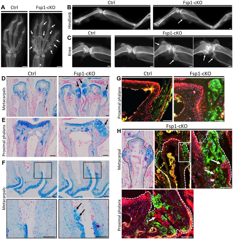 Inactivation of <i>Ptpn11</i> in <i>Fsp1-Cre</i>-expressing fibroblasts induces ectopic cartilage formation.