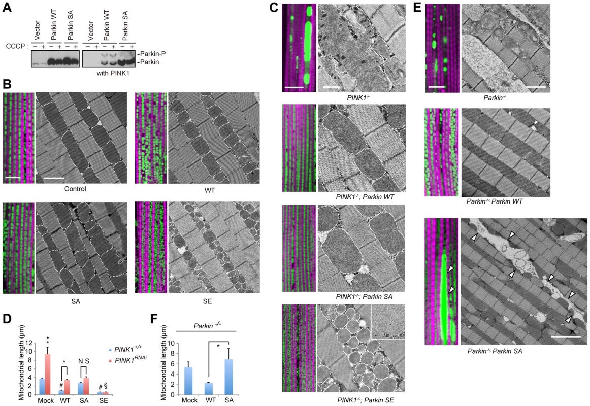 Phosphorylation of the Parkin Ubl domain regulates mitochondrial morphology.
