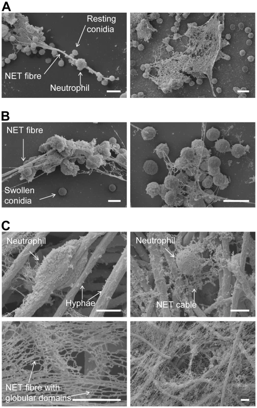 Scanning electron microscopy (SEM) micrographs of conidia and hyphae trapped in NETs.