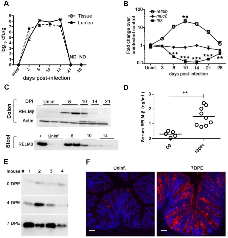 Dynamics of RELM-β expression during <i>C</i>. <i>rodentium</i> infection.