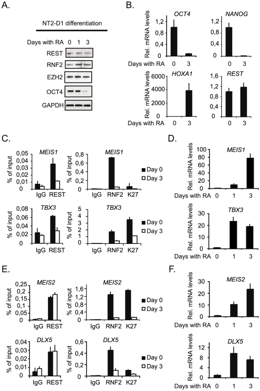 Neuronal differentiation in NT2-D1 cells.