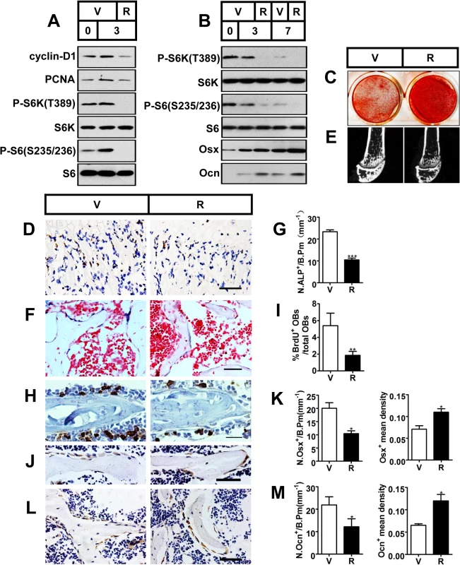 Inactivation of mTORC1 prevents preosteoblast proliferation but enhances their differentiation <i>in vitro</i> and <i>in vivo</i>.