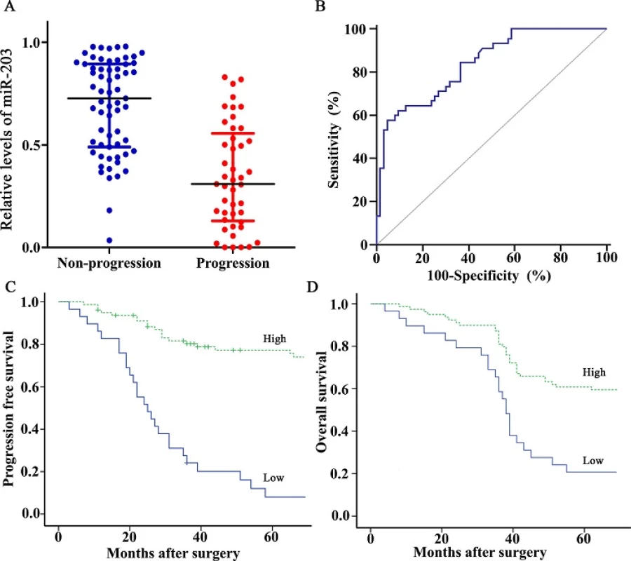 Expression and prognosis of miR-203 for bladder cancer patients treated with cisplatin-based chemotherapy. (A) miR-203 levels were detected by RT-qPCR method and normalized against U6 RNA in 108 cases of bladder cancer tissues. Levels of miR-203 in progression group were significantly lower than those in non-progression group (P<0.001, Mann-Whitney U test). (B) ROC curve distinguished patients with progression from those
without progression using miR-203, with an area under the ROC curve value of 0.839 (95% CI, 0.756–0.903). (C, D) Kaplan-Meier PFS and OS curves based on miR-203 expression of bladder cancer patients. The optimal cut off value (0.345) calculated by ROC analysis was used to classify the patients as high and low miR-203 expression groups. Low expression of miR-203 was significantly correlated with shortened PFS or OS (Both P<0.001, log-rank test).