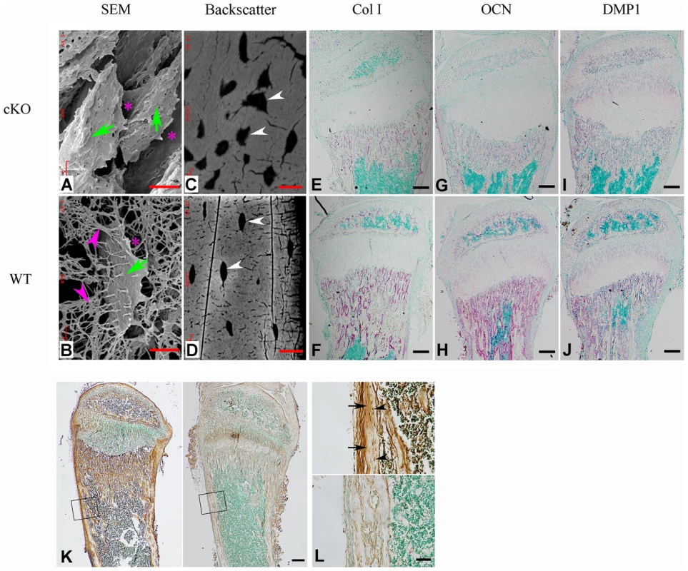 FAM20C is essential to the differentiation of bone cells.