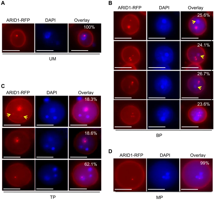 ARID1 localization is developmentally dynamic during sperm cell formation.