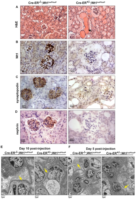 Severe kidney phenotype in the adult conditional <i>Wt1</i> KOs.