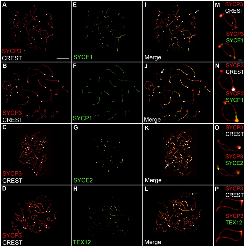 Localization of synaptonemal complex central element components during diplonema.