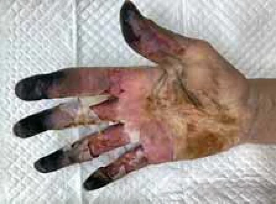 Appearance of right hand (palm view).