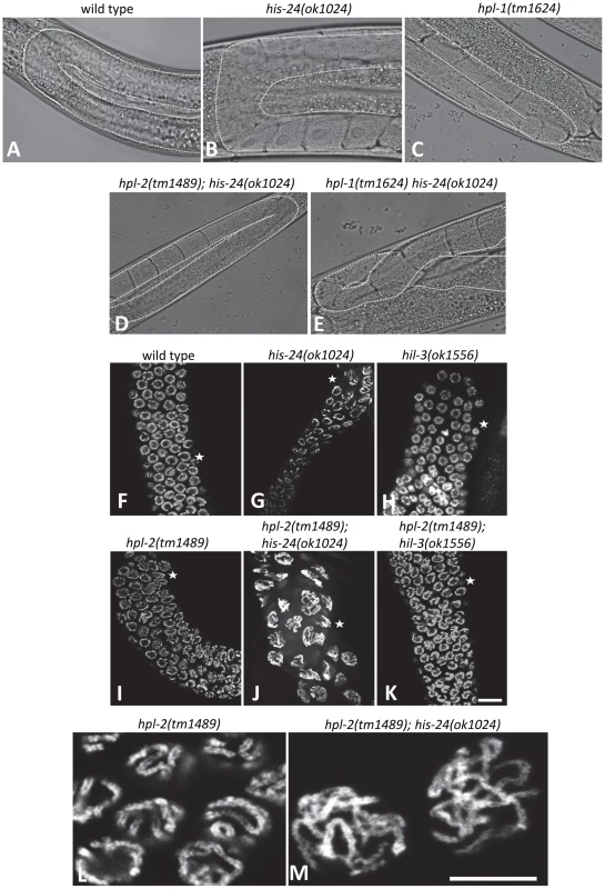 HIS-24 and HPL-1/-2 depletion results in abnormal somatic gonad development and reduction of chromatin compaction.