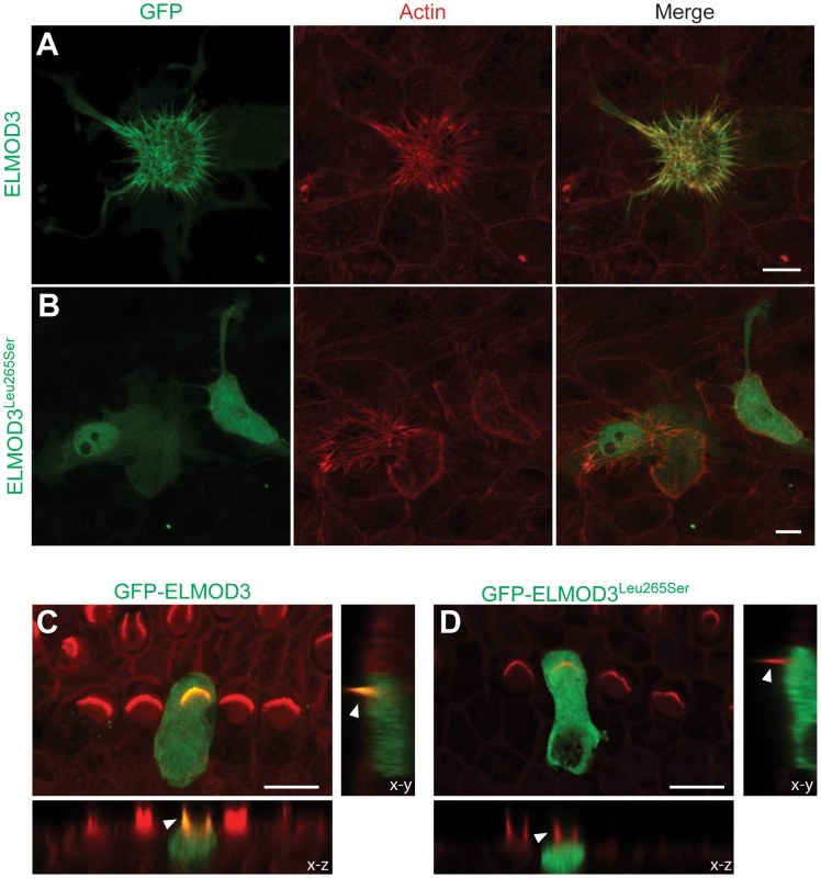 ELMOD3 accumulates at actin-based structures.