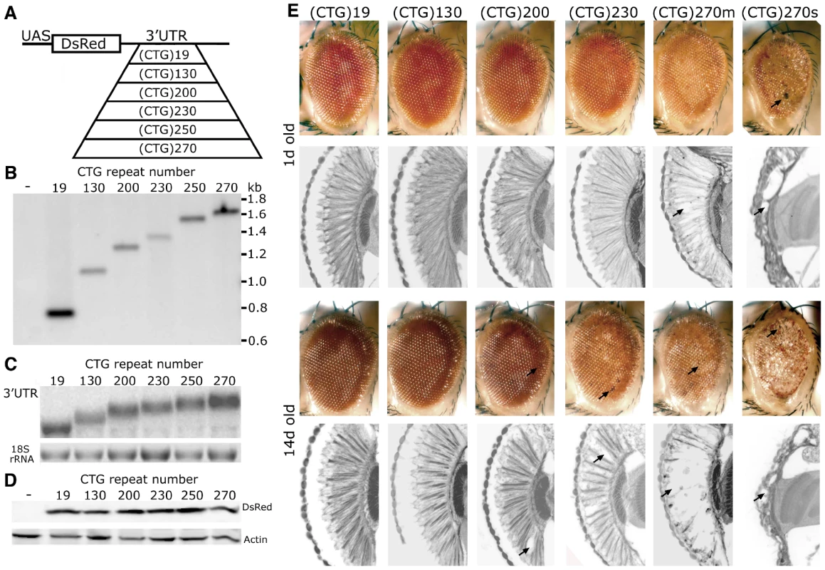 CTG repeat transcripts cause repeat-length dependent toxicity.