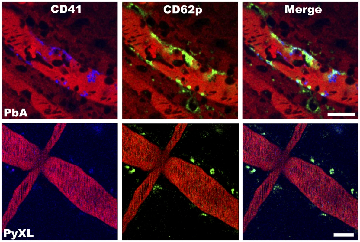 ECM correlates with the arrest of P-selectin expressing platelets in postcapillary venules.