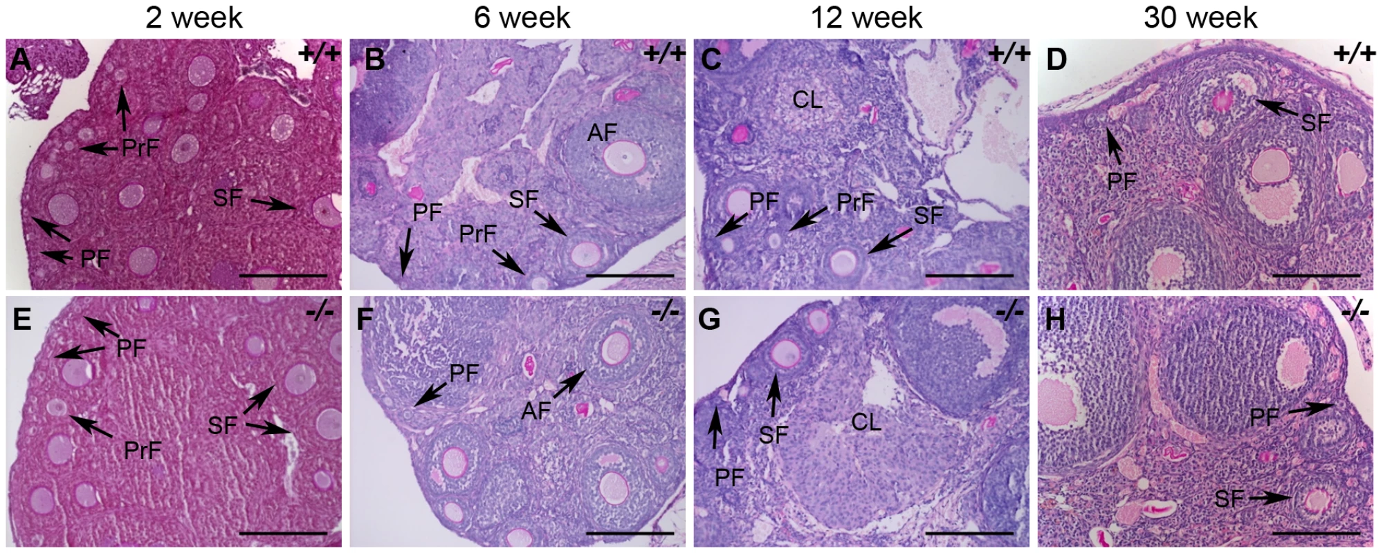 Histological analysis of wild-type and <i>Hormad1</i><sup>–/–</sup> ovaries.