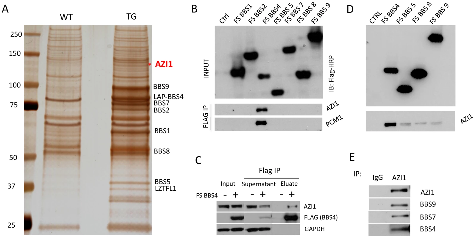 AZI1 interacts with the BBSome through BBS4.