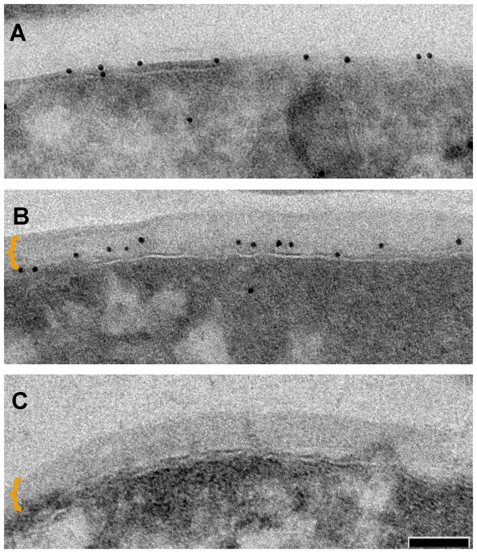 Distinction between the mycomembrane and the outermost layer.