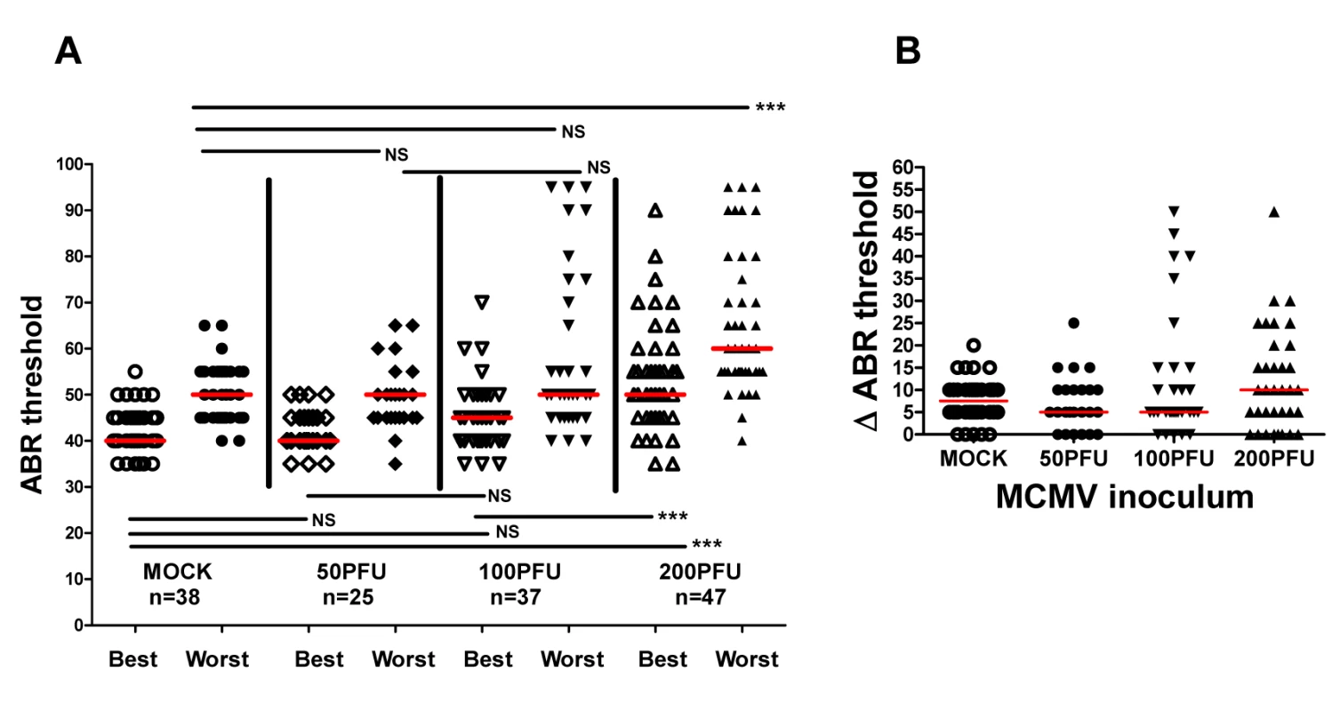 Virus inoculum dependence of ABR thresholds in individual ears of infected animals.