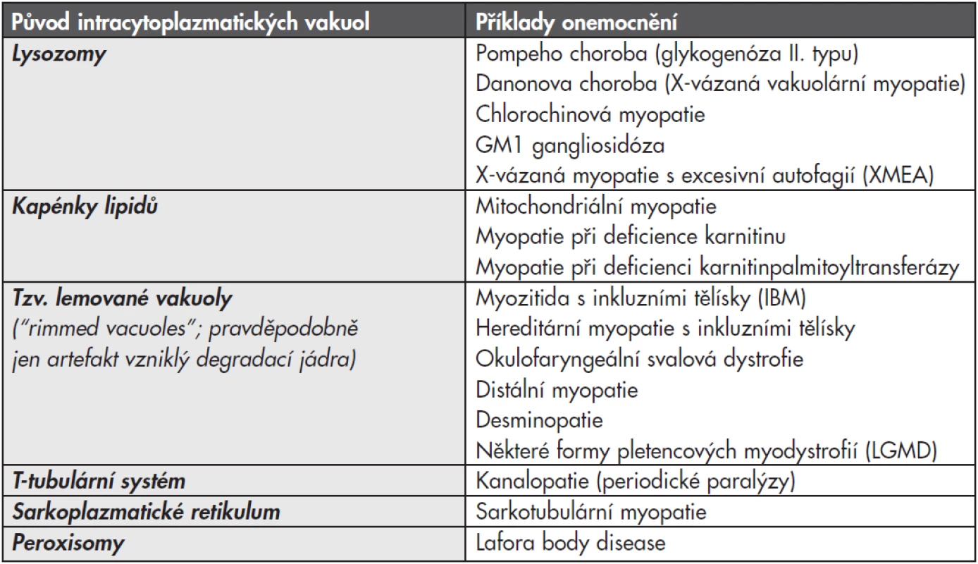 Diferenciální diagnostika vakuol ve svalové biopsii.