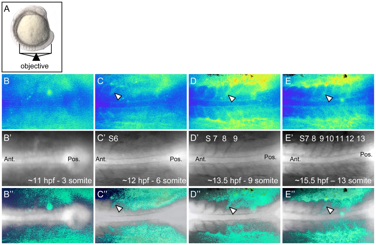 Ca<sup>2+</sup> dynamics during zebrafish somitogenesis.