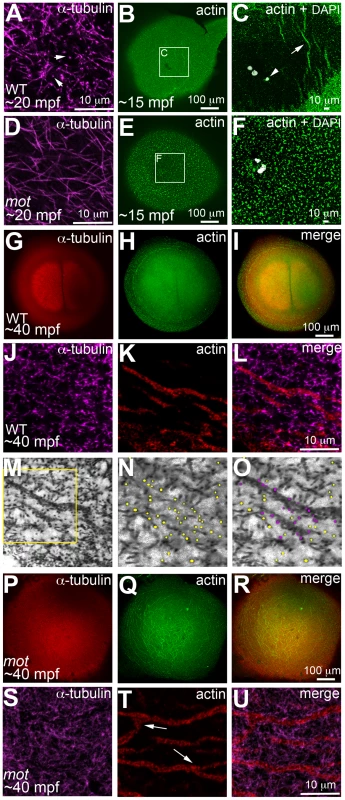 <i>motley/birc5b</i> mutants fail to rearrange cortical actin microfilaments.